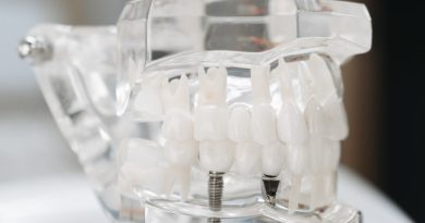 Transparent Dental Implant Model 390x205 - How to Identify the Right Type of Dental Implant for You
